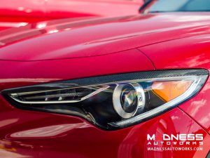 Alfa Romeo Stelvio Headlight Trim Kit - Carbon Fiber